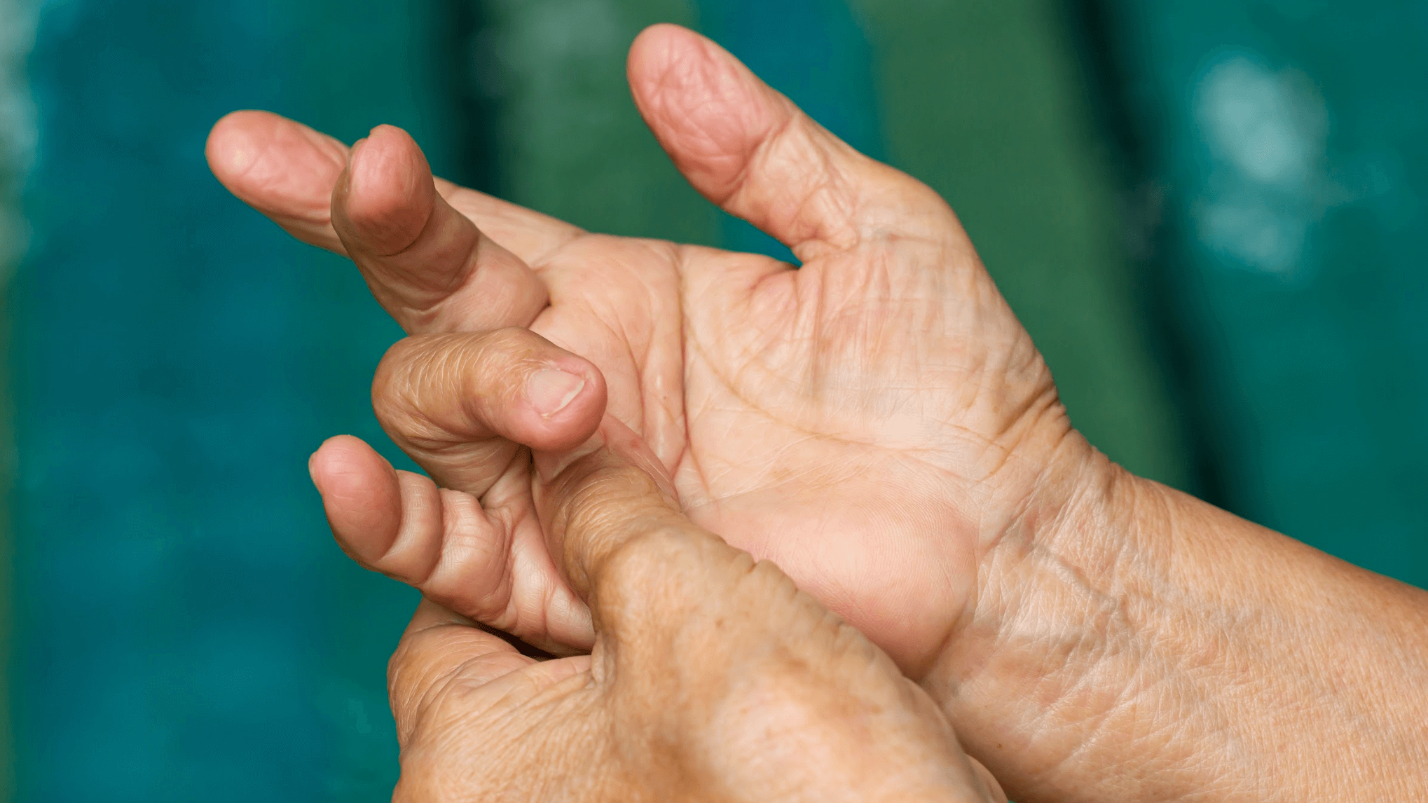 Can Hand CMC Joint Arthritis be Prevented?