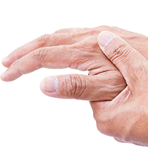 Arthritis