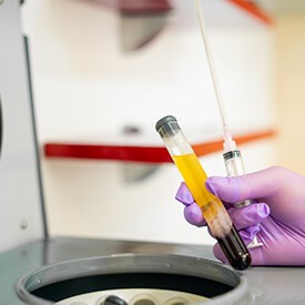 PRP Therapy
