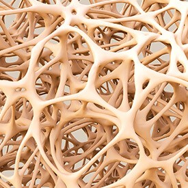 Demineralized Bone Matrix
