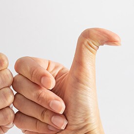 Hypermobility