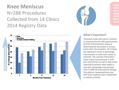 Atlanta, GA | Outcome Data | Interventional Orthopedic